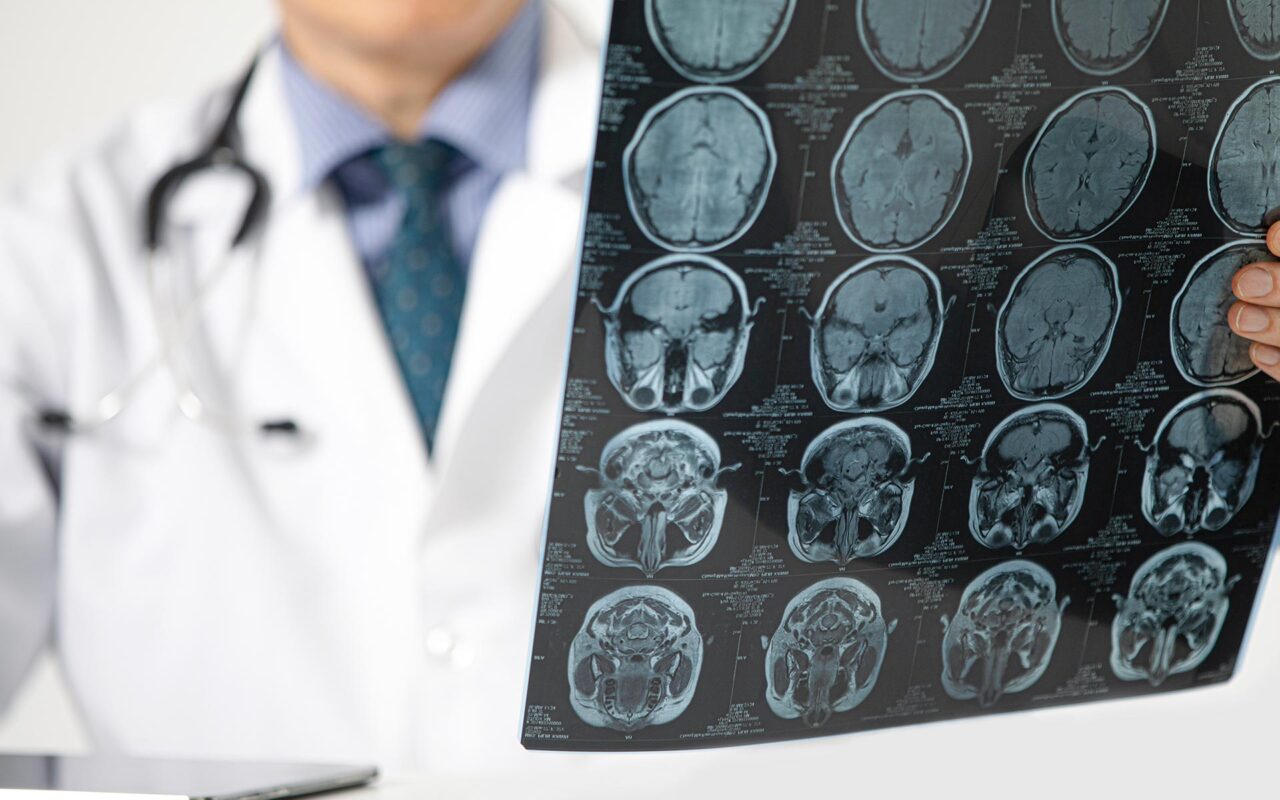 Pandemi beyni yaşlandırdı: Covid olmasanız bile etkilenmiş olabilirsiniz