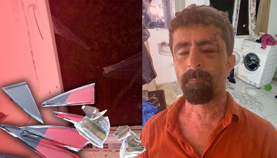 Kayınpederini cam parçalarıyla kesti