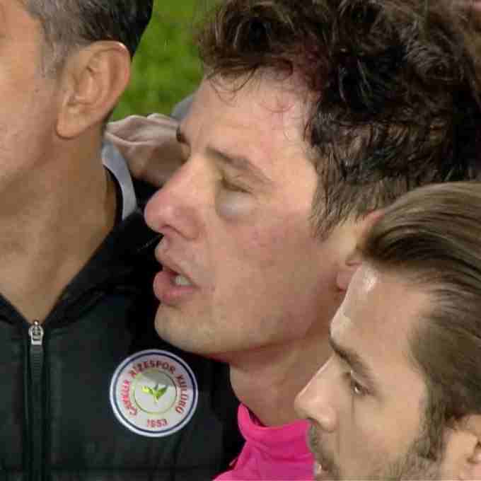 Yazıklar olsun…Ankara’da utanç gecesi...Halil Umut Meler'e saldırı